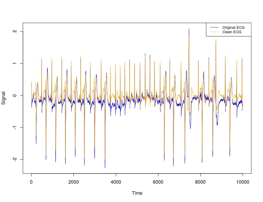 Plot of original and processed ECG signal