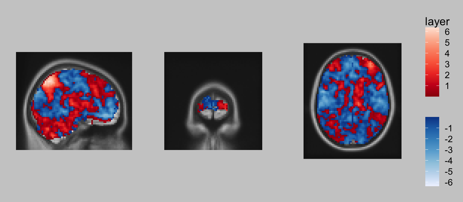 Three views of a brain